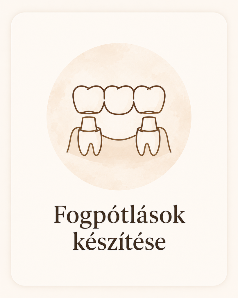 Fogpótlások készítése Szegeden